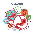 PPI & Gastrointestinal Range