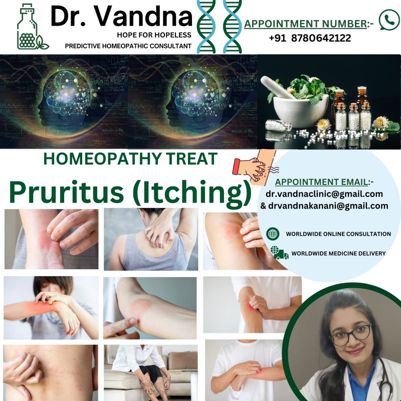 World Best Homeopathic Physicians Consultation For Skin Problem Pruritus