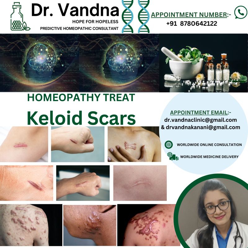World Best Homeopathic Physicians Consultation For Skin Problem Keloid Scars