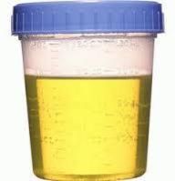 Distilled Cow Urine