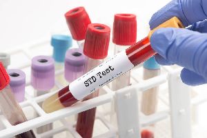 STD Testing Service