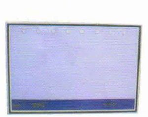 Electric X-Ray Board, Color : White Standard