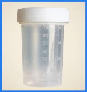 Plastic 60ml Urine Culture Bottle, Shape : Cylandrical