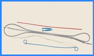 Polyurethane Ureteral Indwelling Double Pigtail Stent Set