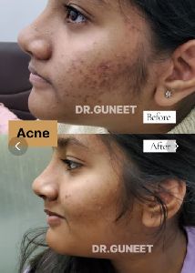 Chronic Diseases Treatment Services