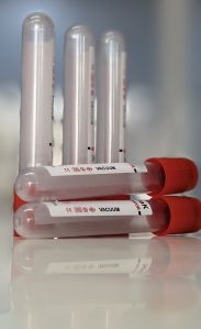 Plain Serum Vacuum Blood Collection Tube