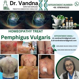 Best Homeopathy Doctor Skin Specialist For Pemphigus Vulgaris