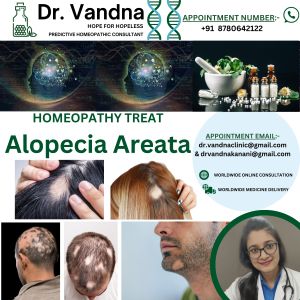 Homeopathy Skin Treatment Alopecia Areata