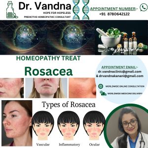 Homeopathy Skin Treatment Rosacea
