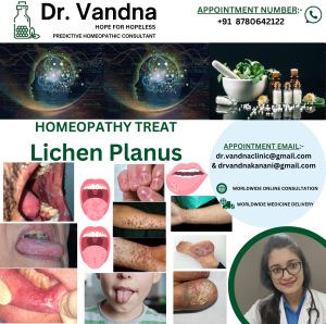 Online Doctor Dermatology Service