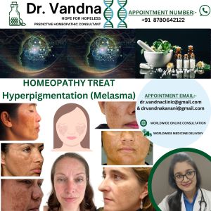 Online Homeopathy Consultation Services For Skin Problem Hyperpigmentation