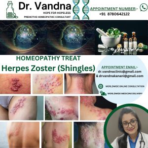 Online Homeopathy Consultation Services For Skin Problem Herpes Zoster
