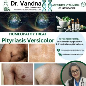 Online Homeopathy Consultation Skin Treatment Pityriasis Versicolor