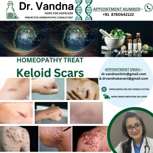 World Best Homeopathic Physicians Consultation For Skin Problem Keloid Scars