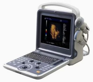 SY-A042N Portable 4D Color Doppler System