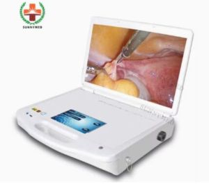 SY-PS046 1080P HD Hysteroscopy System